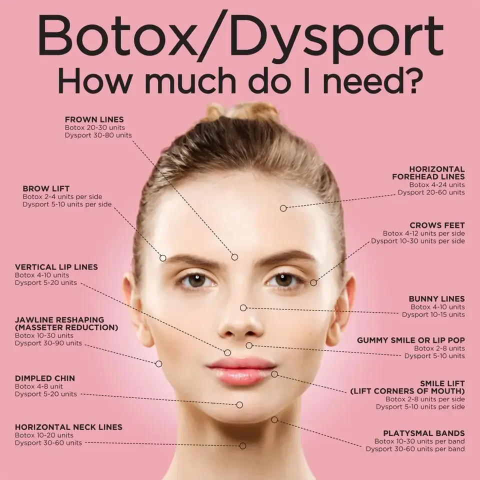 A woman 's face with botox and dysport labeled.